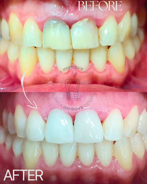 Slider image (5) Improve Dental